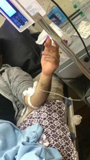 رب أسرة مصاب بسرطان الكولون 