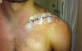 رب أسرة معيل بحاجة لعلاج 