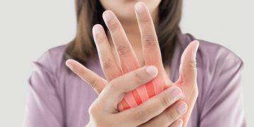 سيدة تعاني من مرض مناعي شديد 