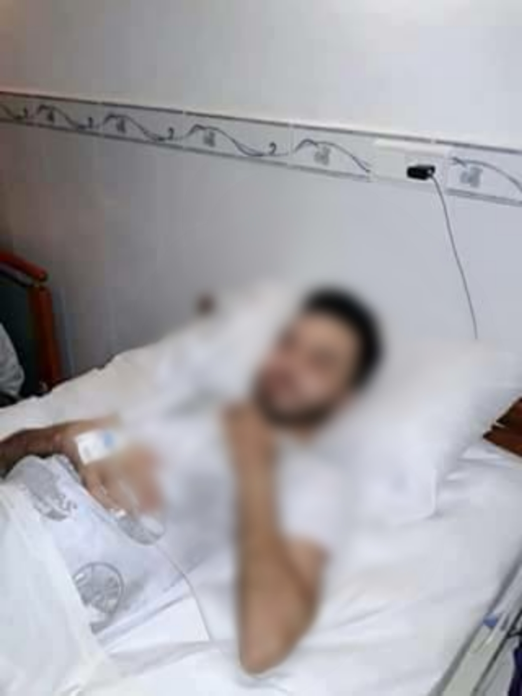 مريض بحاجة لعملية لإيقاف نزيف بالمريء.