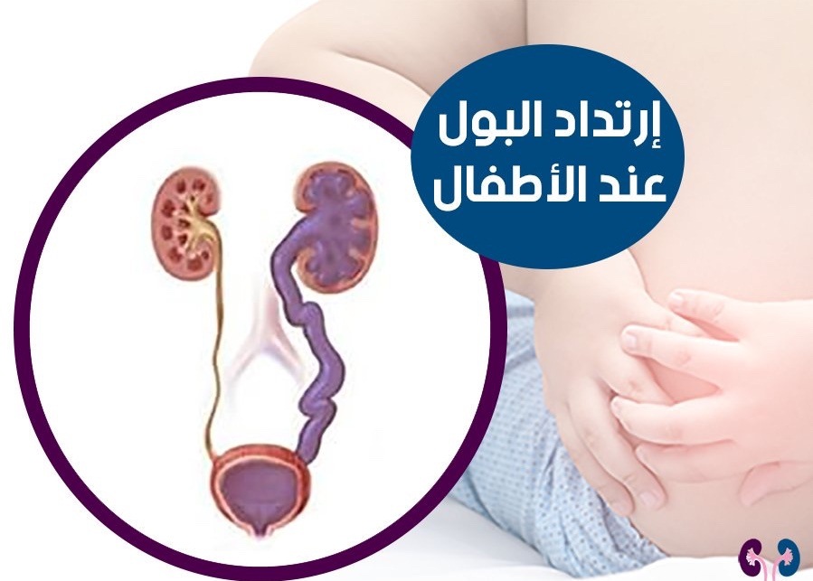 طفلة بحاجة إلى زرع حالبين