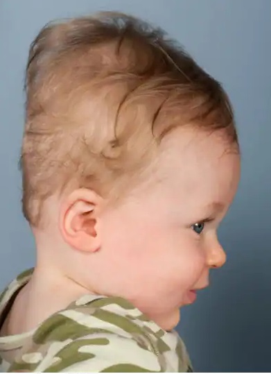 الطفل زهير بحاجة لعمل جراحي في المخ