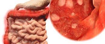 أحمد يستصرخ ألامه 