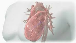 الحجة غادة بحاجة إلى قسطرة ودعامات بشكل عاجل 