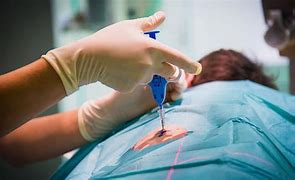 السيد معن بحاجة لمساعدتكم في تأمين تكاليف الخزعة الكلوية 