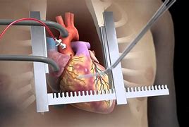 نورا في ريعان شبابها تعاني من تشوه خلقي في القلب