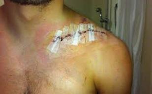 رب أسرة معيل بحاجة لعلاج 