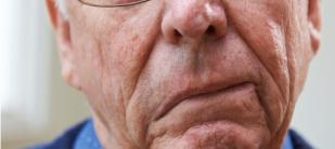 رب اسرة مصاب بجلطة في الدماغ