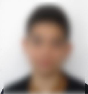 طفل يتيم بحاجة لاستئصال عينه اليسرى.