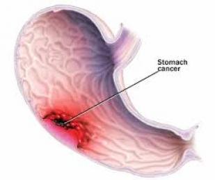  تنهش الأوجاع جسد الحاج مأمون