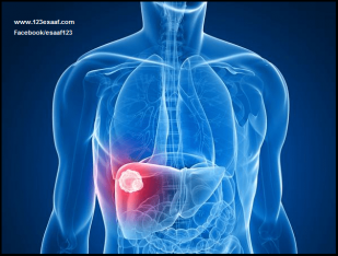 عائشة تحتاج لعملية بشكل عاجل 