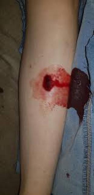 شام تعرضت لحادث يتطلب تدخل جراحي فوري