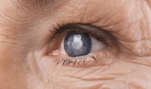 الحجة مهيبة تعاني من اعتلال سكري في العين بحاجة إلى عملية فورا