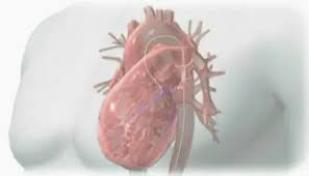 الحجة غادة بحاجة إلى قسطرة ودعامات بشكل عاجل 