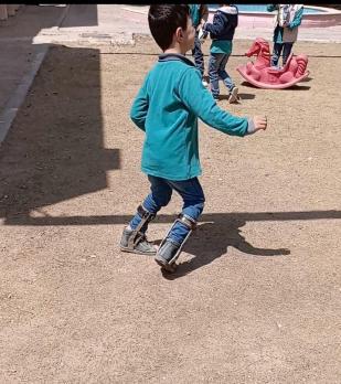 مالك يعاني من قصر بعضلات السمانة 