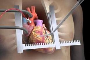 نورا في ريعان شبابها تعاني من تشوه خلقي في القلب